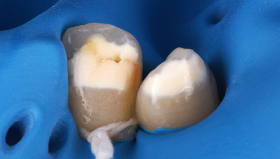 icon(アイコン)治療前